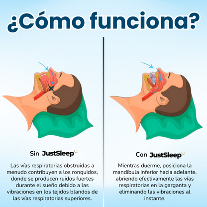 JustSleep™ No Snore Mouth Guard