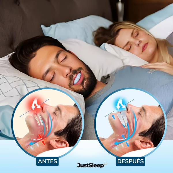 JustSleep™ No Snore Mouth Guard